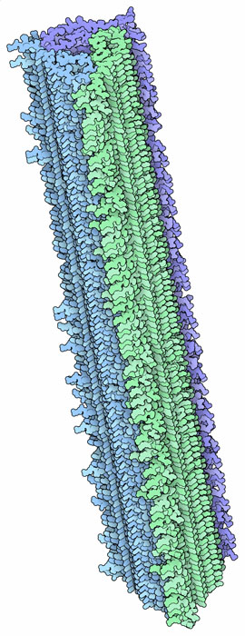 Amyloid-beta fibril from a patient with Alzheimer's disease.